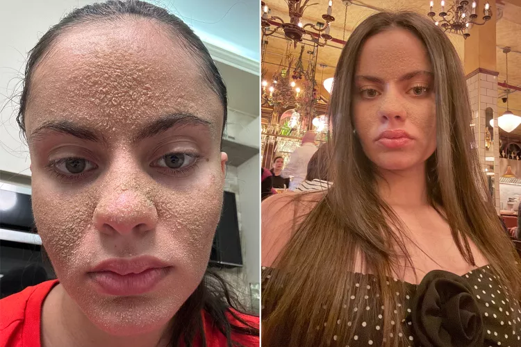 The Caveman Skin Trend: Embracing Minimalist Skincare in 2025